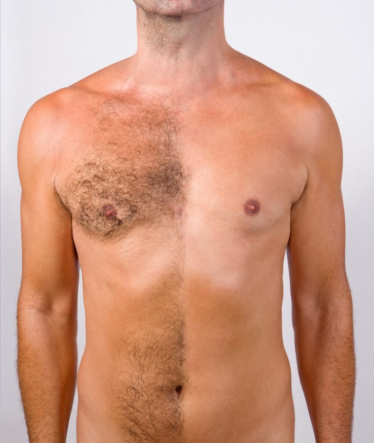 Prince harry porn