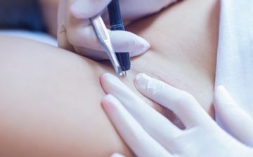 Чем опасна электроэпиляция подмышек. Смотреть фото Чем опасна электроэпиляция подмышек. Смотреть картинку Чем опасна электроэпиляция подмышек. Картинка про Чем опасна электроэпиляция подмышек. Фото Чем опасна электроэпиляция подмышек
